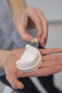 Best Dental Bridges Woombye