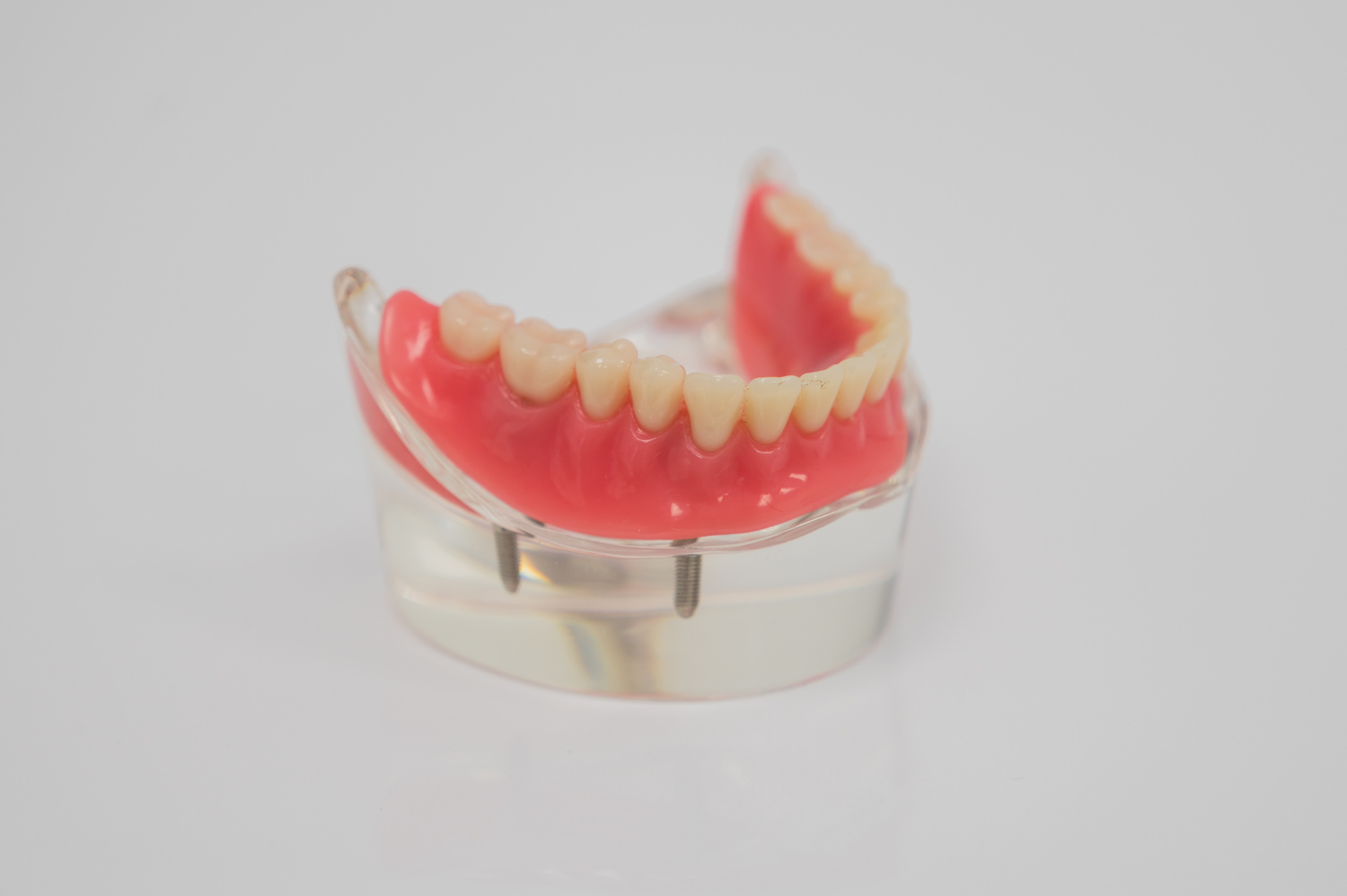 Best and cheap Dentures in Woombye